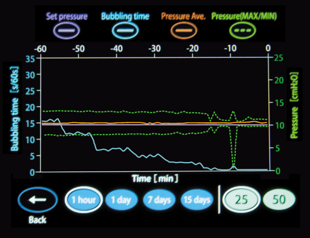 MERA SUCUUM 009 | SENKO MEDICAL INSTRUMENT Mfg. CO., LTD.